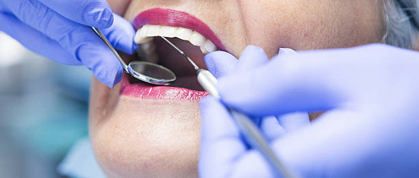 Best Emergency Root Canal Treatment in Five Corners, WA